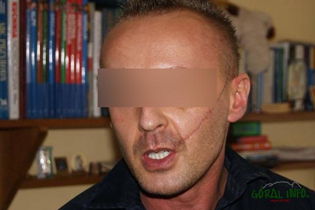 Rabka-Zdrój. Wyrok za molestowanie seksualne 10-letniej dziewczynki
