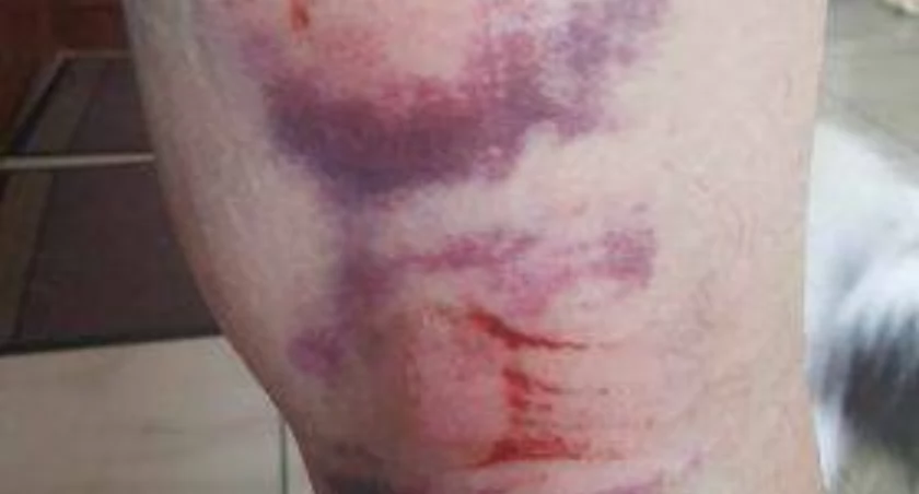[WIDEO] Policjanci zatrzymali mężczyzn, którzy napadli na radomszczanina. Do napaści doszło w czerwcu na Gliniankach