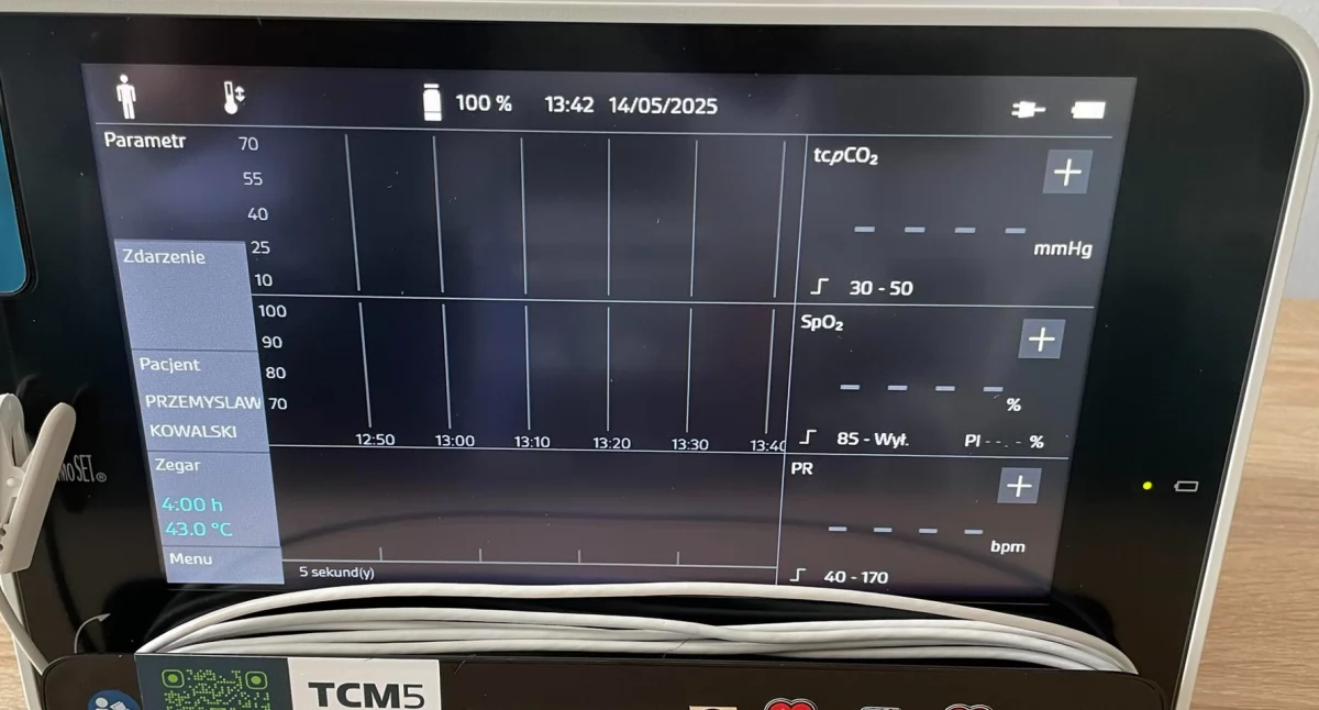 Nowoczesny monitor przezskórny TCM5 FLEX szpitalowi przekazał WOŚP. Urządzenie trafiło do Oddziału Gruźlicy i Chorób Płuc