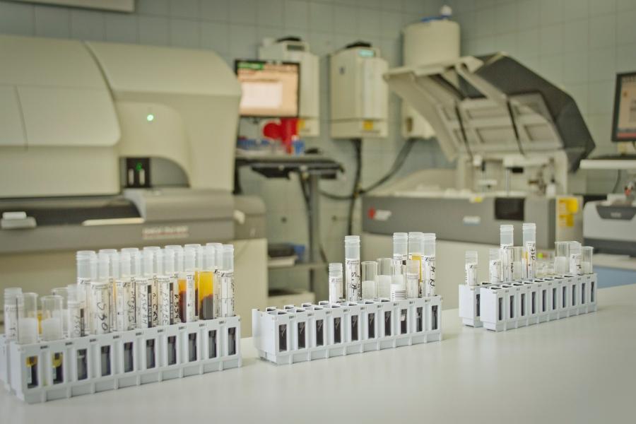 Test na antyciała SARS-CoV-2 w szpitalu. Dla każdego, ale odpłatnie