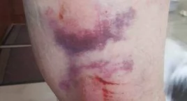 [WIDEO] W. zwrócił im uwagę. Zaatakowali. Stanęli przed sądem i usłyszeli wyrok. A prokurator apelował, bo kara była zbyt... surowa