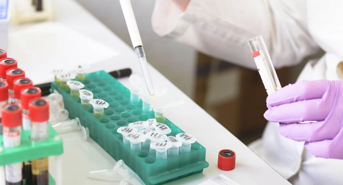 Pipety Pasteura – niezastąpione narzędzie laboratoryjne