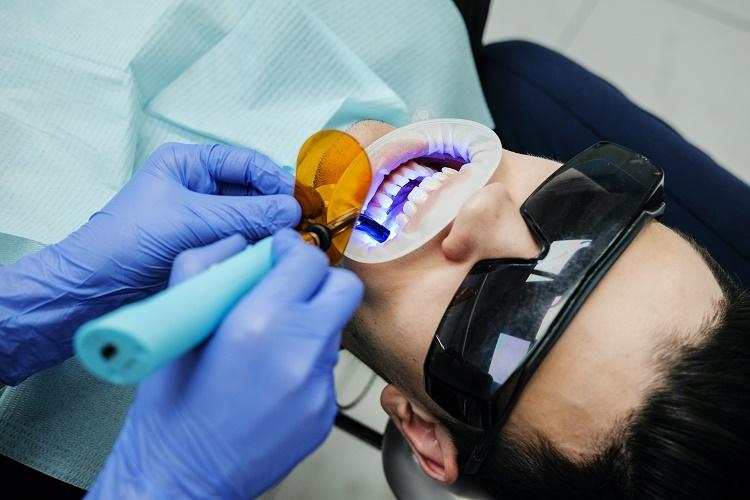 Jaka jest cena implantu zęba w Krakowie? 