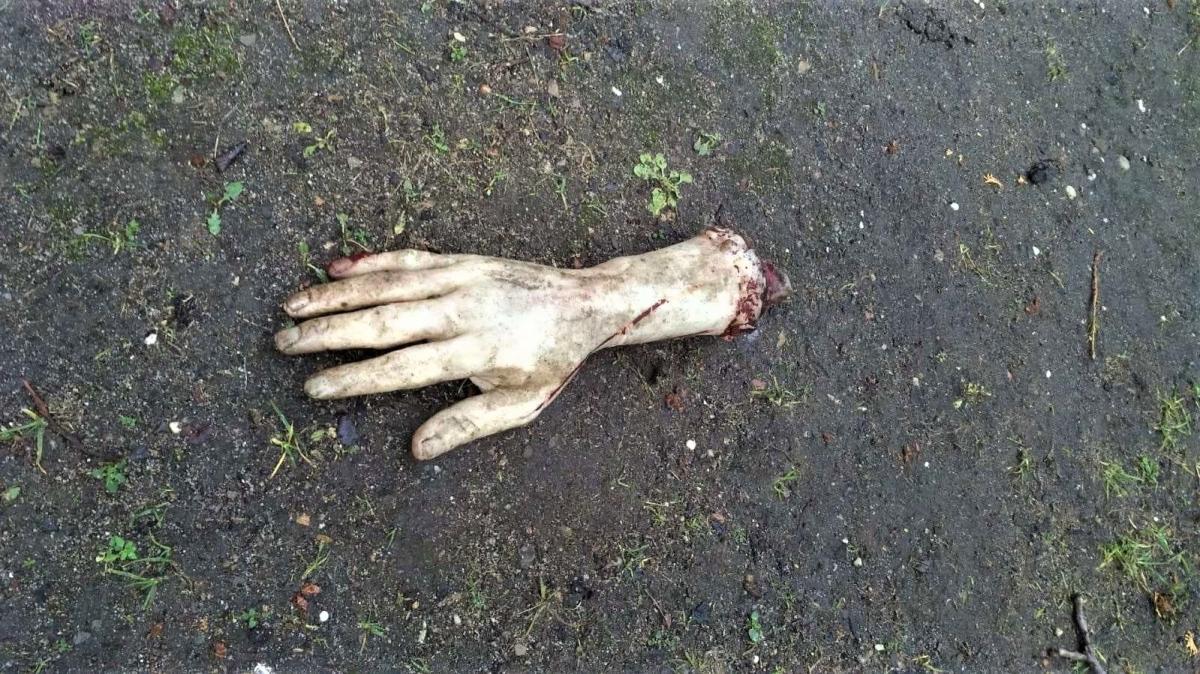 Dostali zgłoszenie, że przed domem leży ręka
