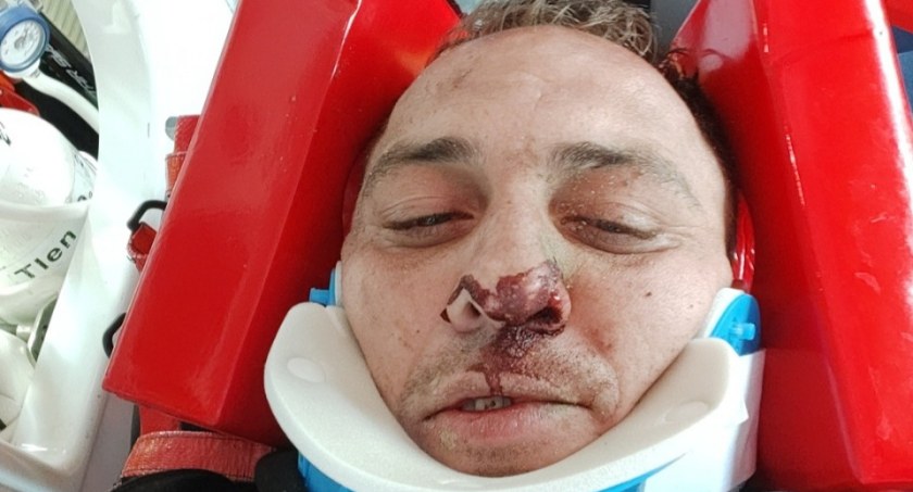 Biała Podlaska: Bialski motocylista założył zbiórkę. Chce szybko wrócić do zdrowia