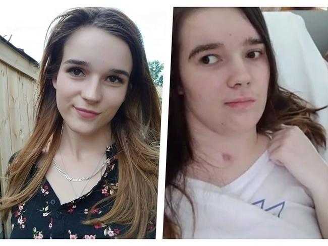 Moment zmienił jej życie na zawsze. Wesprzyj zbiórkę