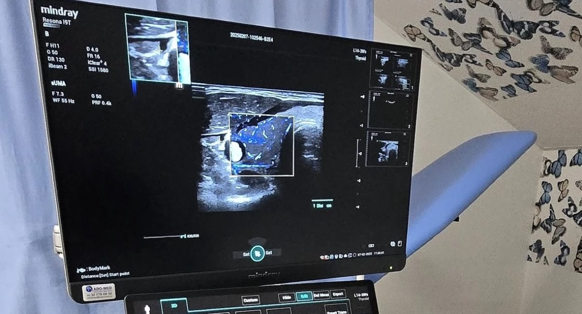 Nowoczesna diagnostyka w Staninie! Ośrodek Zdrowia zakupił zaawansowany aparat USG