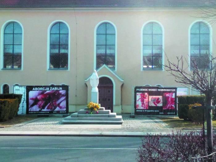Usunęłam ciąże. Chcę o tym opowiedzieć.