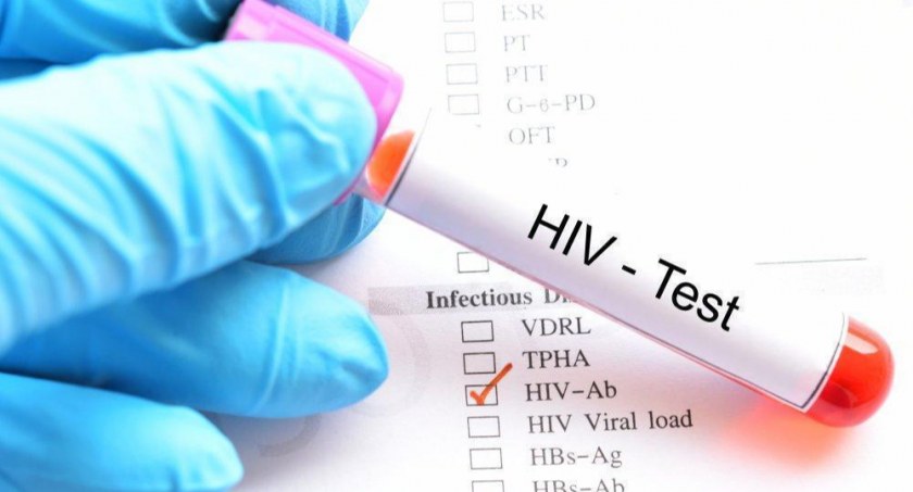 Przyszli lekarze będą edukować o HIV