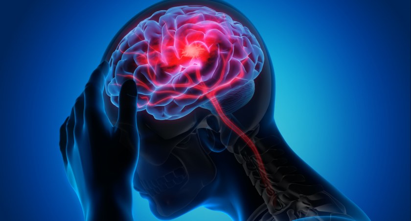 Ekspert: sztuczna inteligencja od dawna wspomaga neurochirurgów