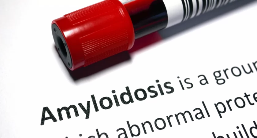 Amyloidoza TTR. Nowe wytyczne dotyczące diagnostyki i leczenia 