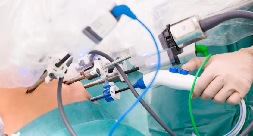 Dr Paweł Wisz operuje nowotwory prostaty z asystą robota w Szpitalu Klinicznym nr 1 Śląskiego Uniwersytetu Medycznego w Zabrzu