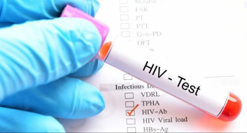 Dr Cholewińska: zakażenia HIV dotyczą dziś głównie ludzi w 