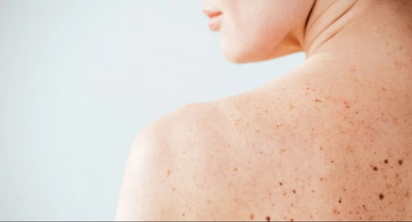 Jak poprawić skuteczność dermatologów w diagnozowaniu chorób?