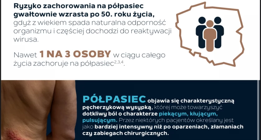Tydzień Świadomości Półpaśca 2024: rusza globalna kampania informacyjna