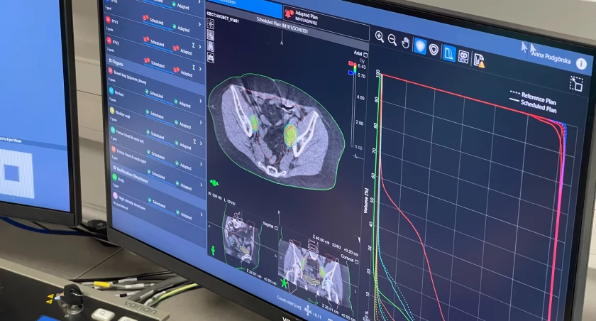 Radioterapia adaptacyjna w gliwickim NIO. Jedyna taka terapia w Polsce