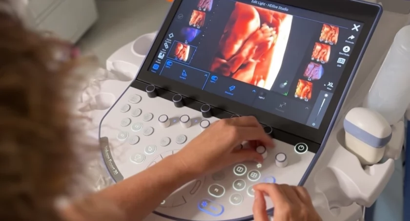 Jeden z najlepszych na świecie aparatów USG do diagnostyki prenatalnej trafił do Katowic