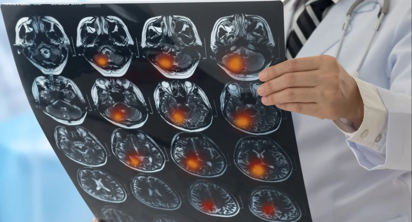 Wrocław. Uniwersyteckie Centrum Neurologii i Neurochirurgii otwarte