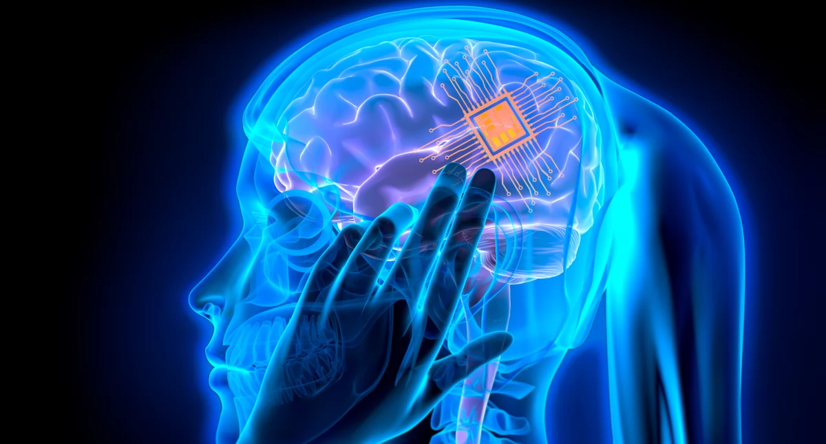 Drugi implant Neuralink wszczepiony. Problem pierwszego się nie powtórzył 