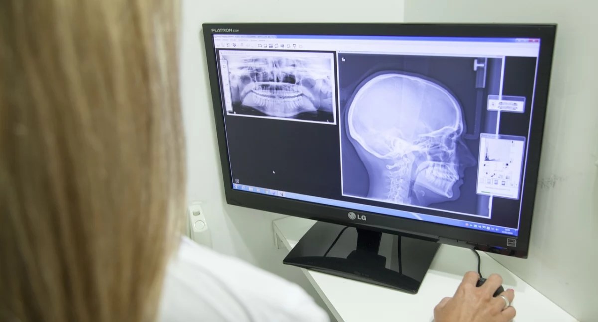 Nowy czujnik od saudyjskich naukowców – prześwietlenia będą bezpieczniejsze