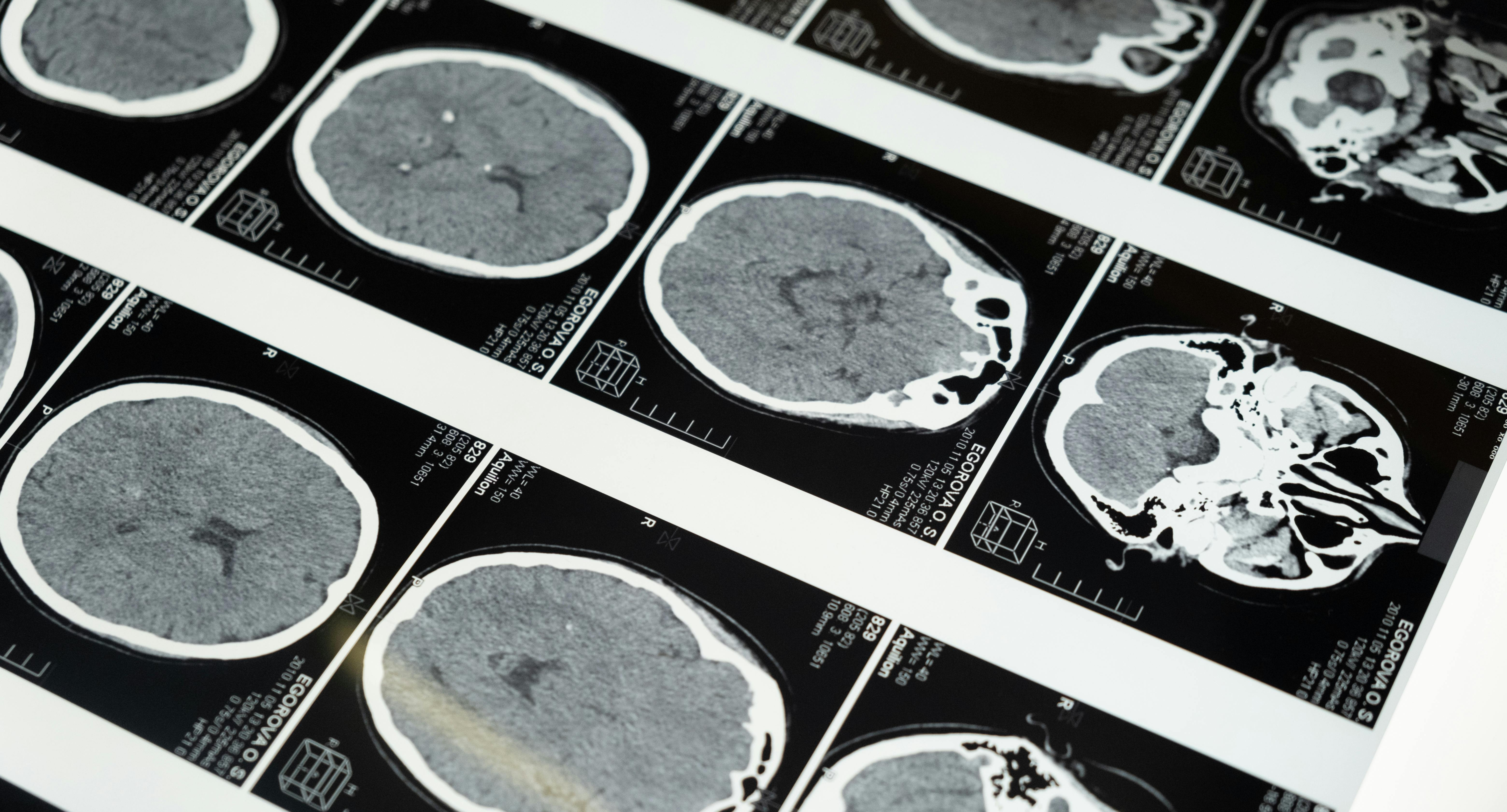 Sztuczna inteligencja w radiologii może wpływać na błędne diagnozy