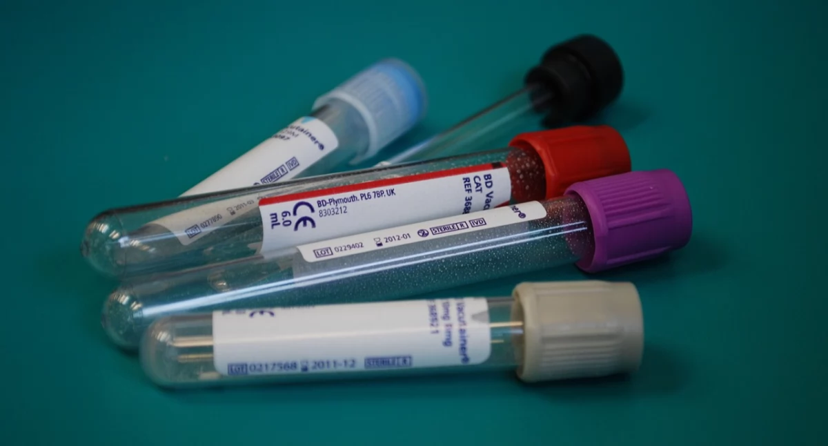 Inwestorzy zdiagnozują Diagnostykę [FELIETON]