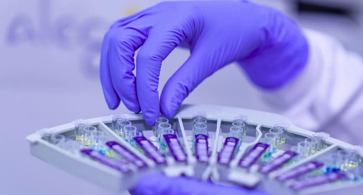 Nowoczesny test moczu pomoże wykryć raka pęcherza na wczesnym etapie