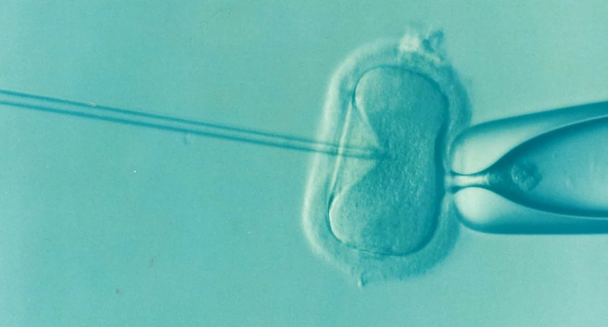 Ponad 23 tys. par wzięło udział w programie in vitro w 2024 roku