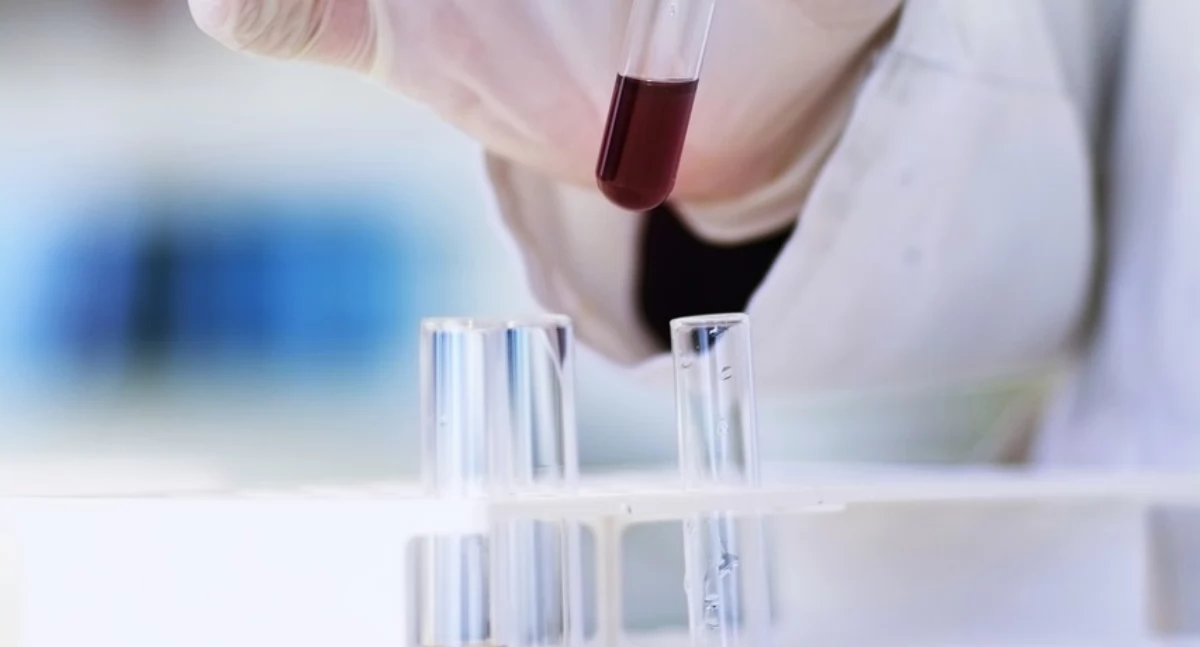 Nowy test pomaga lekarzom przewidzieć niebezpieczny efekt uboczny leczenia raka