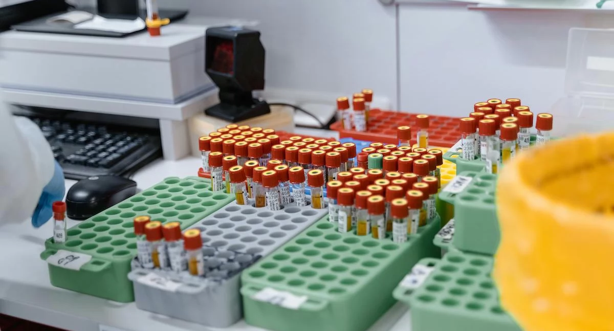 Sztuczna inteligencja może wykrywać raka endometrium z niemal idealną dokładnością