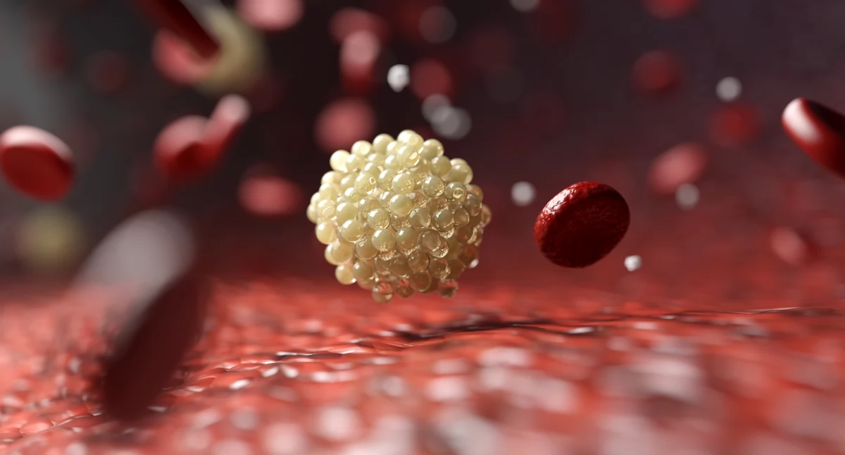 Nie cholesterol jest najgroźniejszy. Po co badać lipoproteinę a?