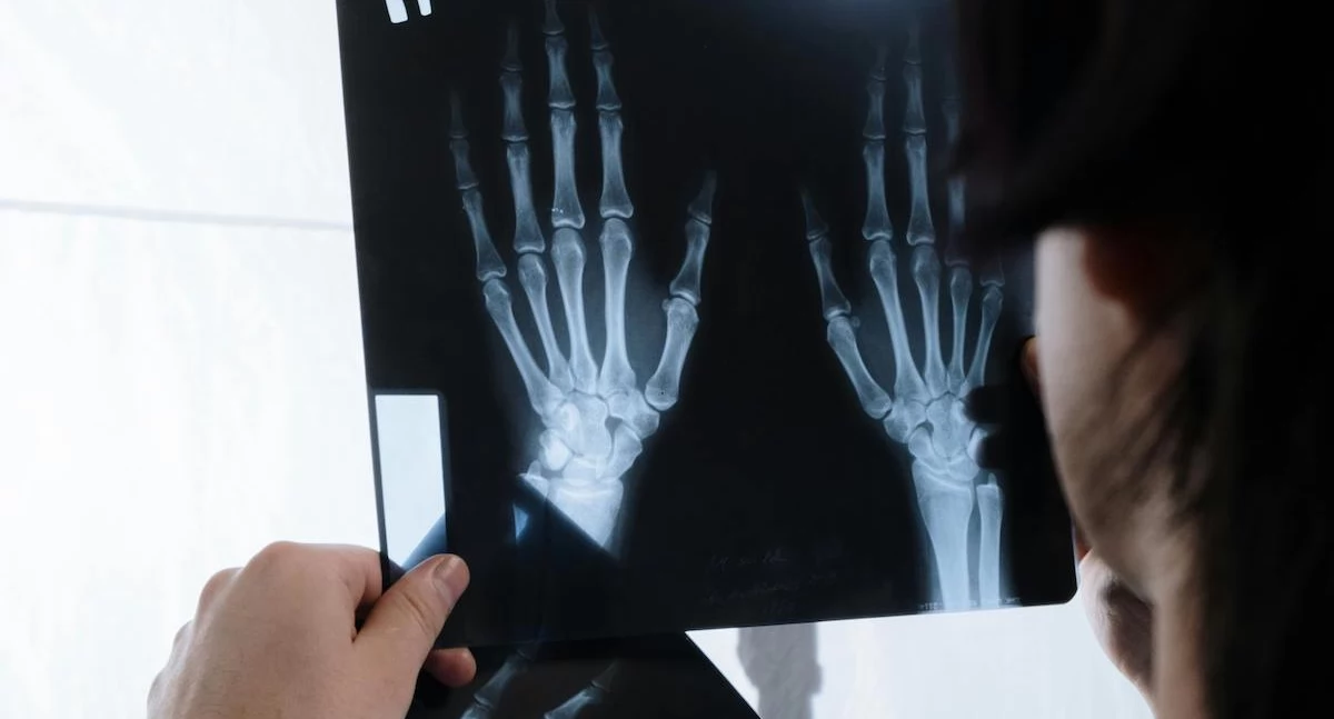 Choroby reumatyczne atakują coraz młodszych. Opieka i diagnoza w Polsce mocno kuleją