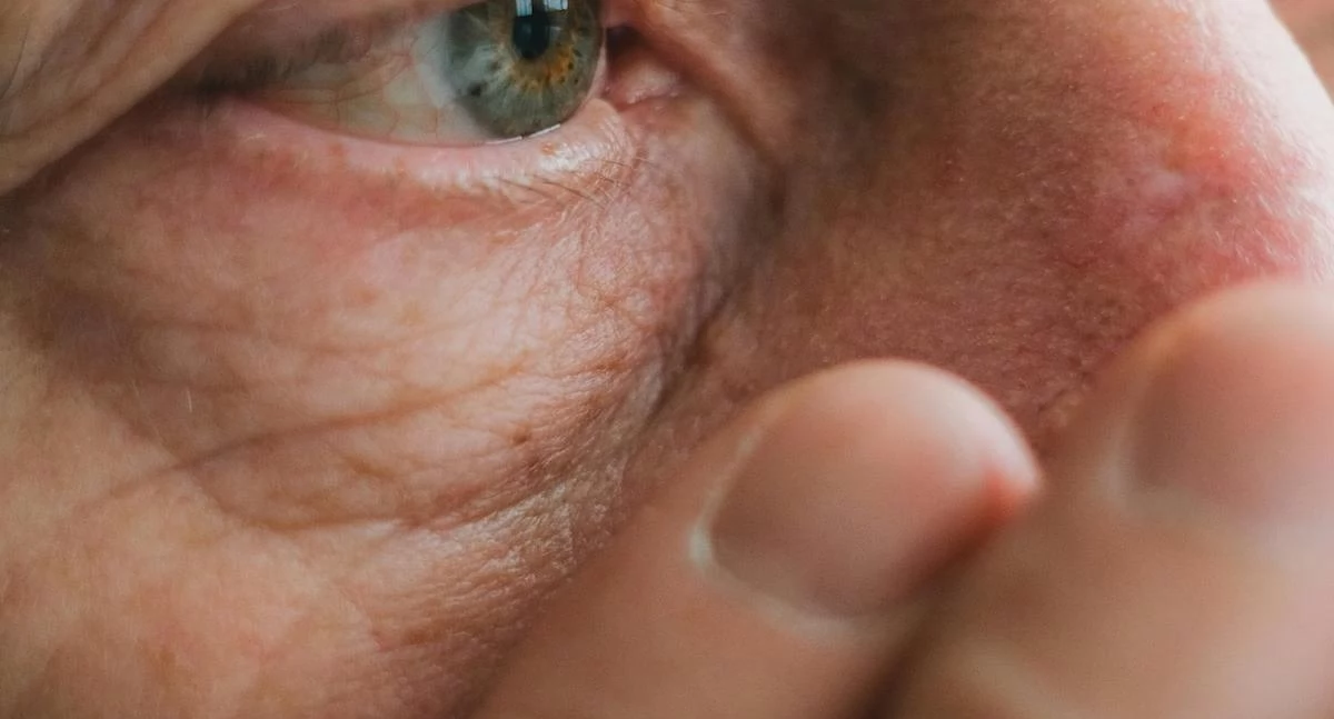 Choroba Parkinsona dotyka coraz młodszych. W Polsce brakuje neurologów i nowoczesnych terapii