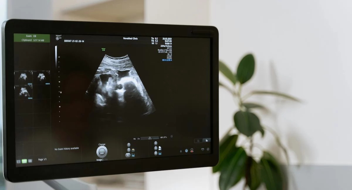 Prawnicy nie mają wątpliwości: Uśmiercenie płodu zdolnego do życia to przestępstwo
