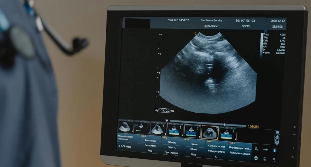 Legalna aborcja w ogniu nagonki. Ginekolożka ze szpitala w Oleśnicy pod presją radykałów