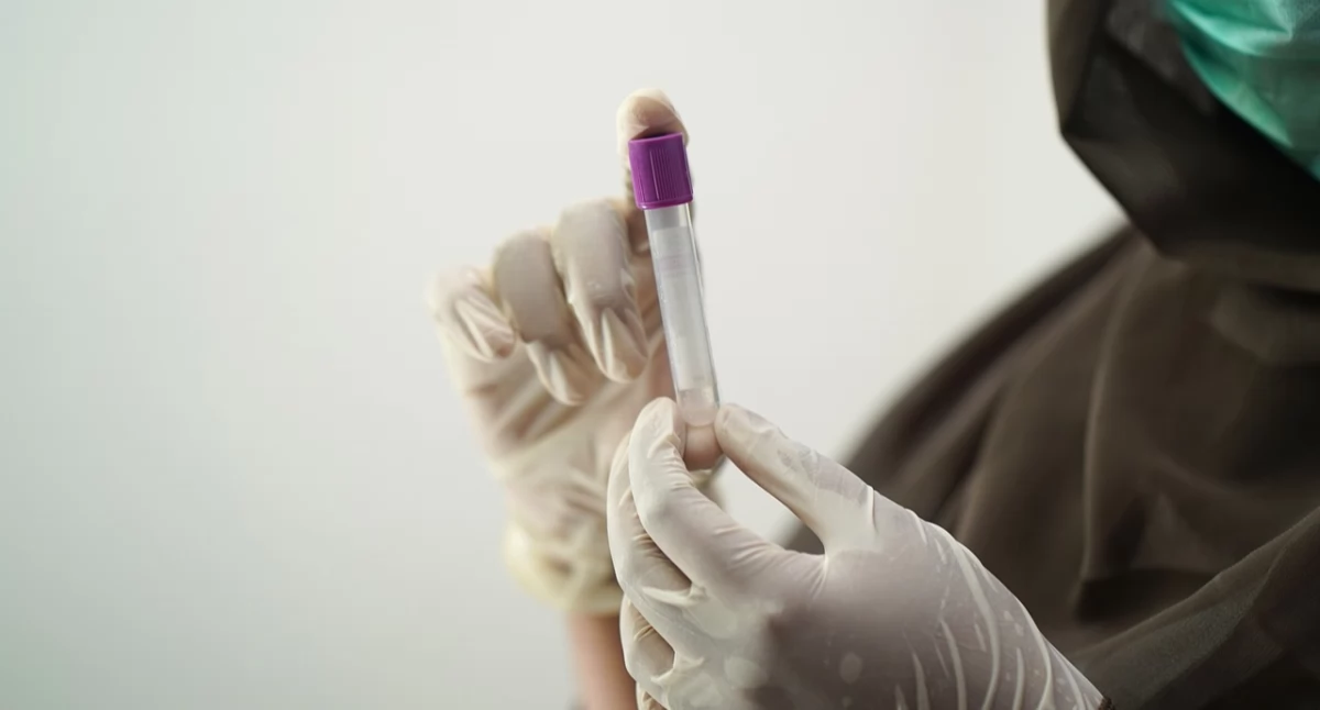 Przełom w walce z czerniakiem. Prosty test krwi może przewidzieć nawrót raka