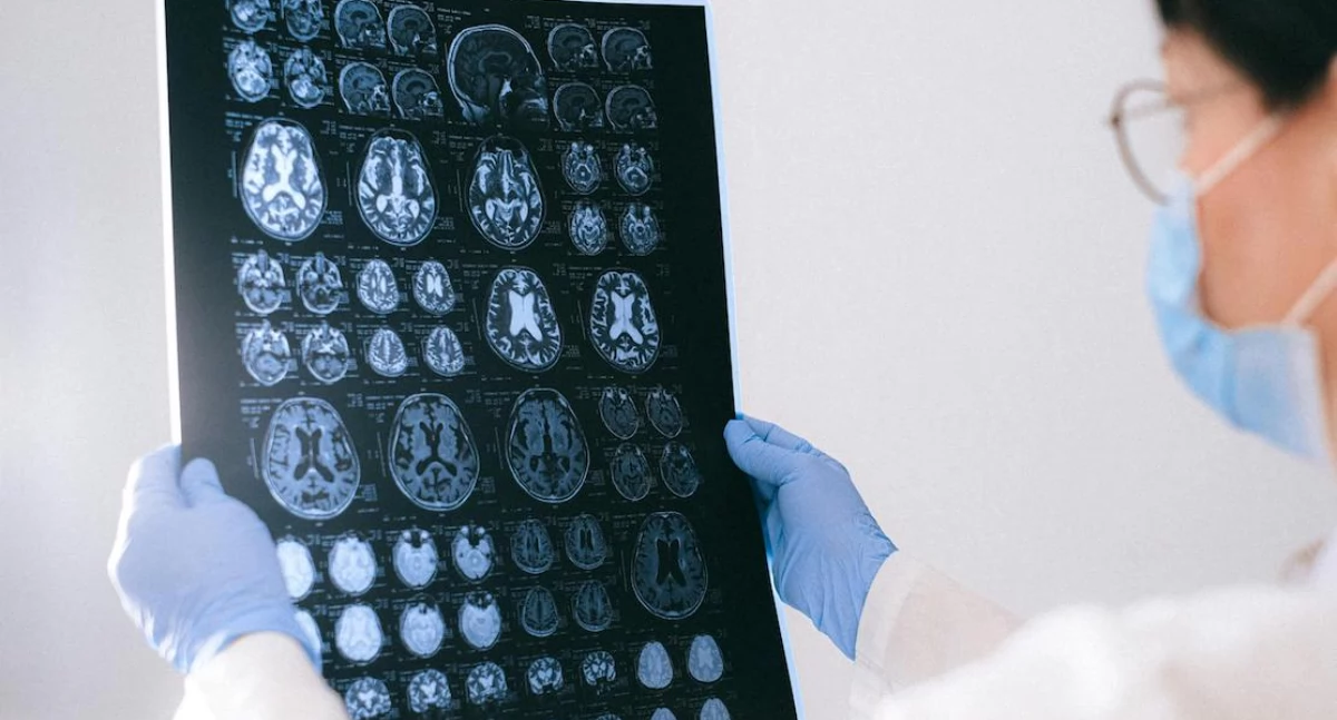 Światowy Dzień Mózgu: Neurolodzy biją na alarm: bez reform opieka neurologiczna w Polsce się załamie