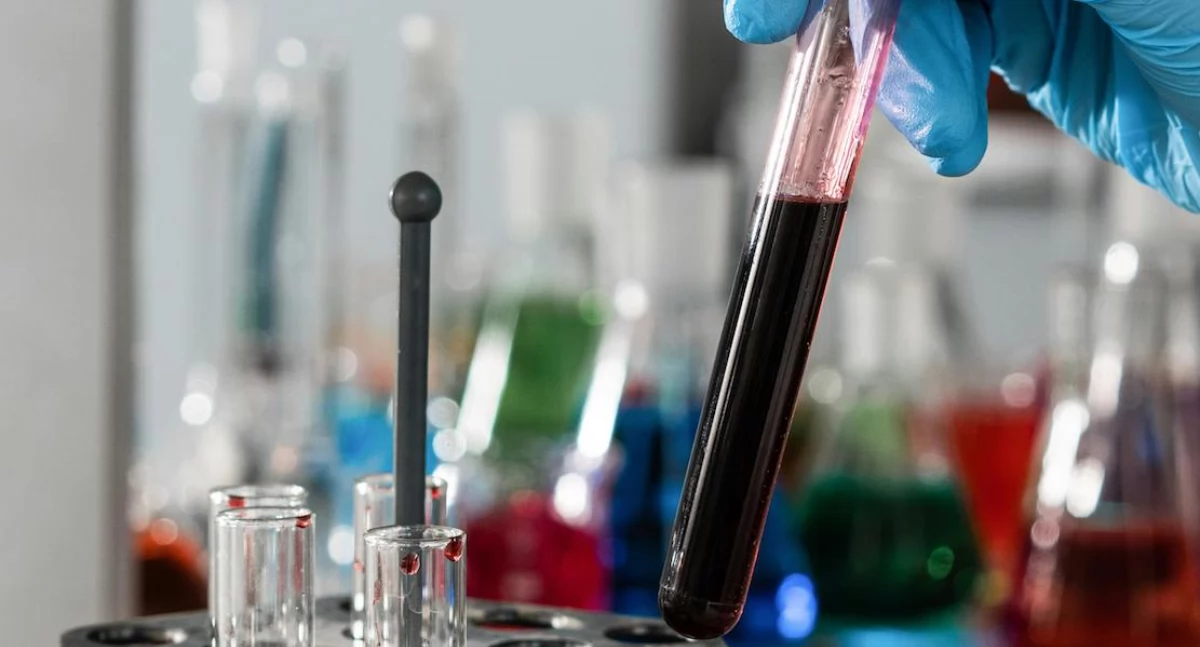 Test z kropli krwi wykrywa zakażenie w 15 minut. Przełomowe odkrycie naukowców z Arizony