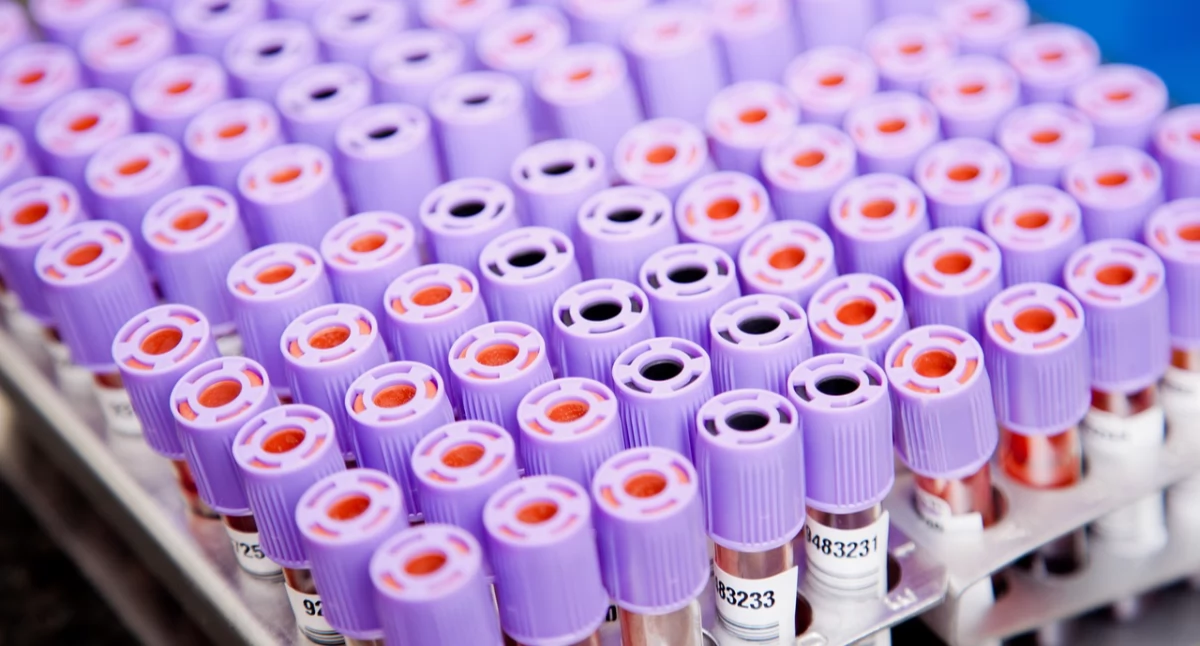Gotowa immunoterapia CAR-NKT może zmienić leczenie raka jajnika