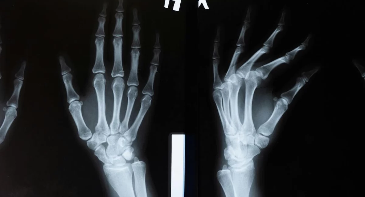 AI i radiolodzy razem skuteczniejsi. Nowa hybrydowa metoda w mammografii