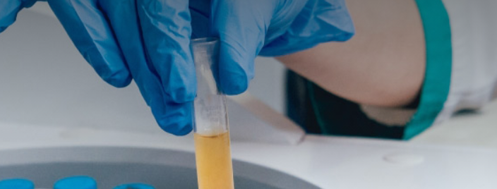 Roche przy współpracy z ABM rusza z badaniem nad lekiem p/COVID-19