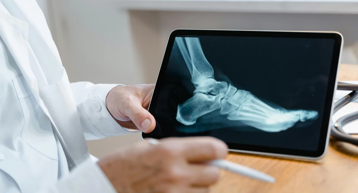Nowy cel w leczeniu osteoporozy: receptor GPR133. Przełom z Lipska i co to oznacza dla polskich pacjentów?