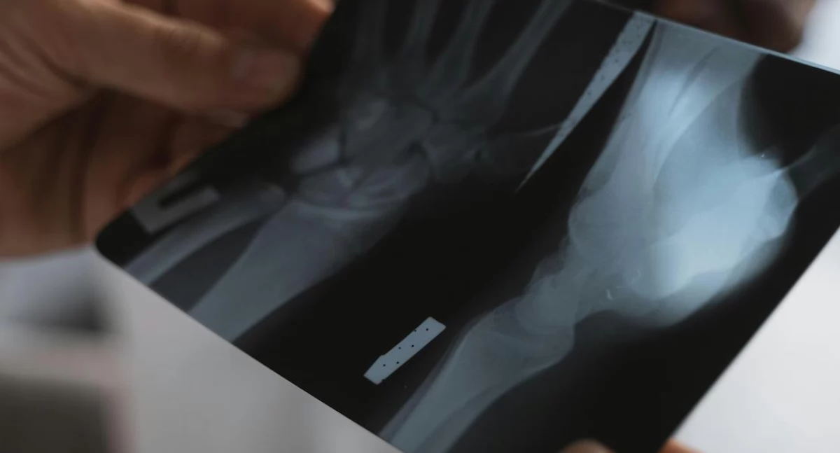 100 lat Polskiego Lekarskiego Towarzystwa Radiologicznego. Stulecie, które odmieniło polską medycynę