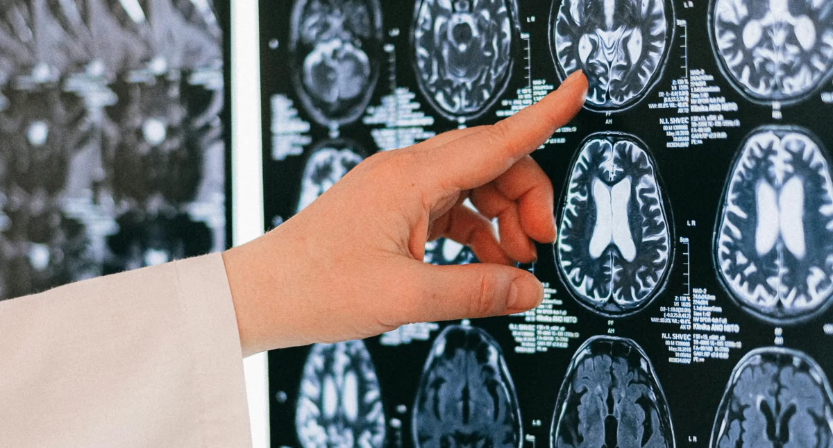 90 proc. pacjentów bez dostępu do leczenia. Dr. hab. Grzegorz Rosiak z WUM: „Radiologia interwencyjna to przyszłość, której jeszcze nie mamy”