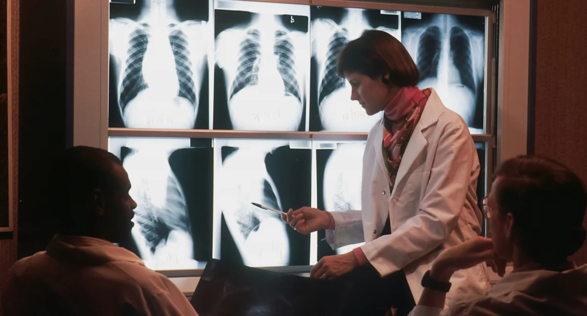 Dlaczego immunoterapia raka nie działa? Naukowcy odkrywają brakujący element układanki