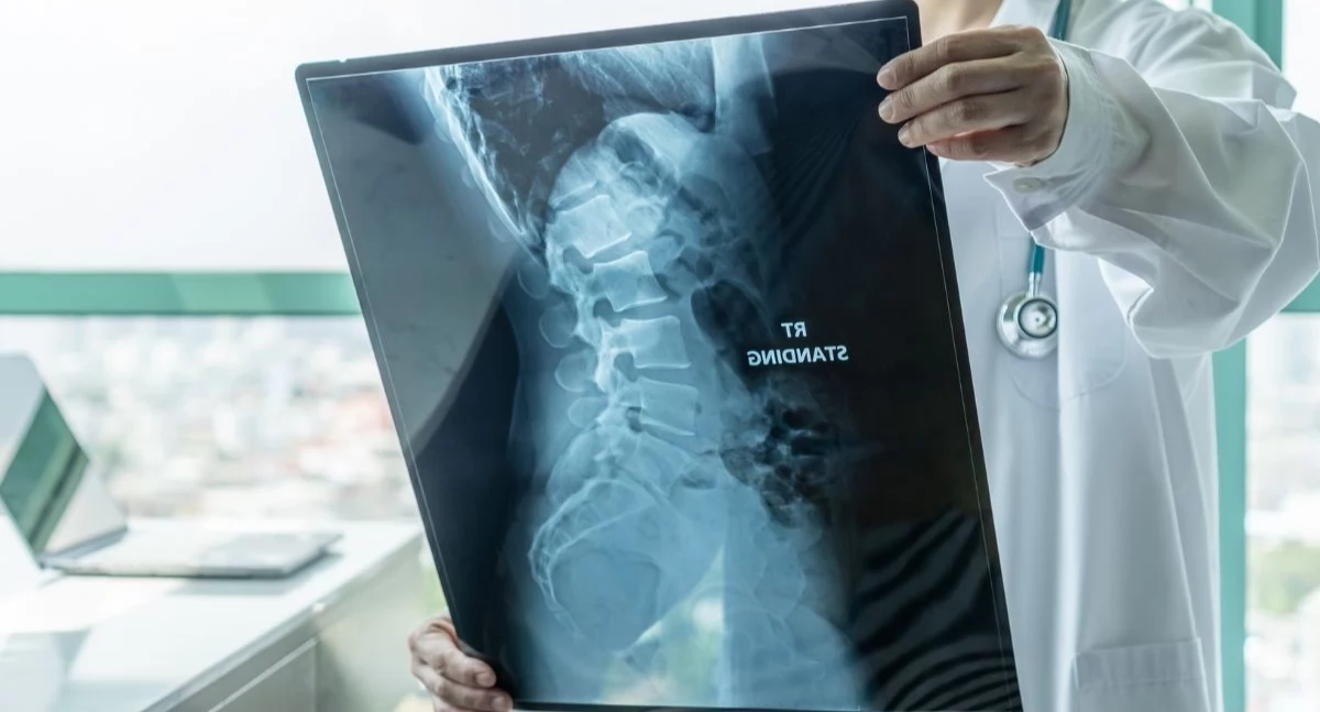 Świetne wyniki programu lekowego. Skuteczność leczenia chorych na SMA to niemal 100 procent