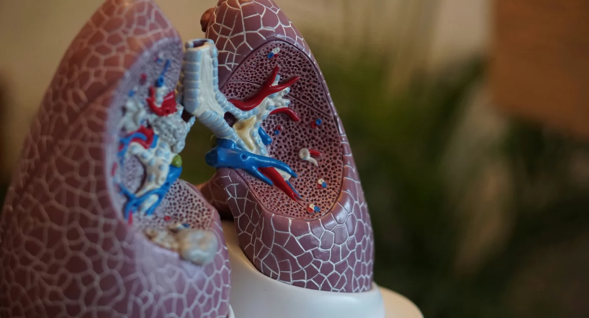 Nowy sprzęt kardiologiczny w Pleszewskim Szpitalu za 2 mln zł
