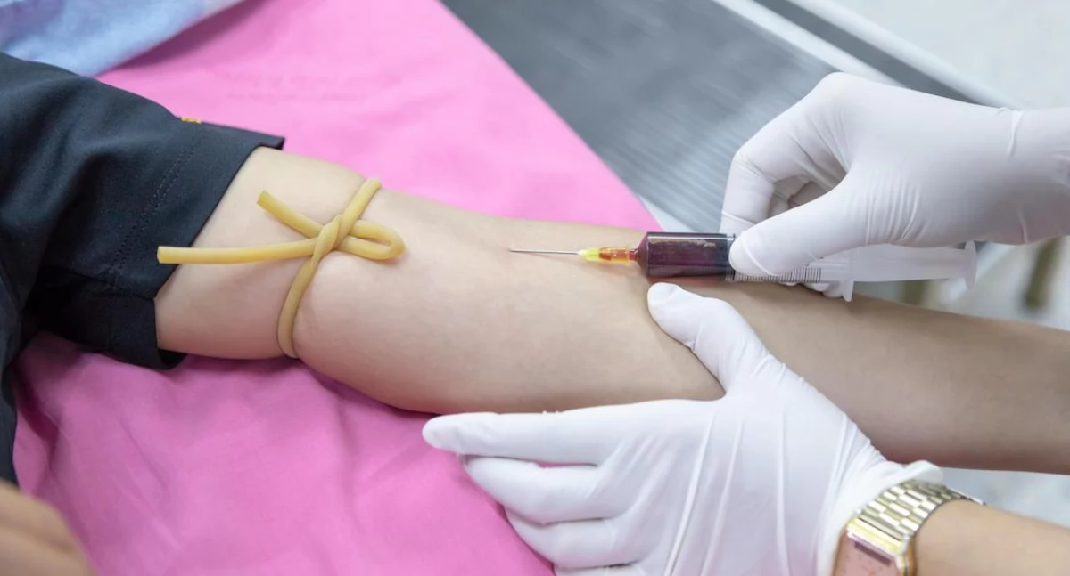 Wykrywanie raka głowy i szyi bez biopsji. Panele biomarkerów mogą zmienić sposób monitorowania pacjentów