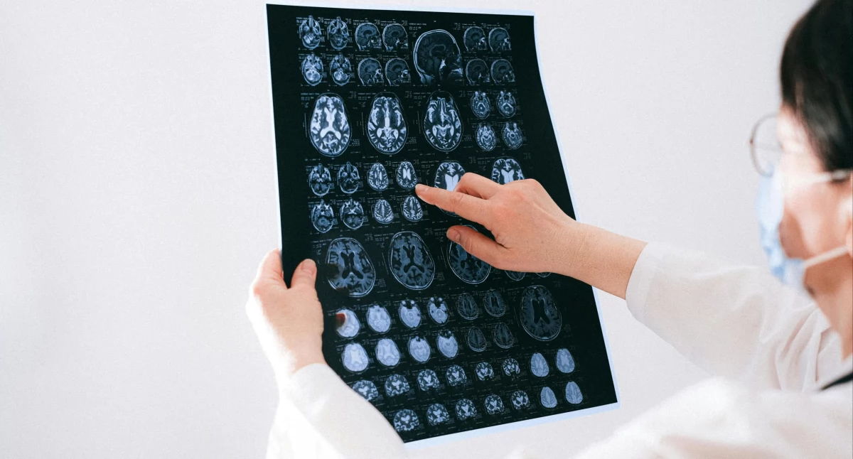 Nowe podejście do diagnozy stwardnienia rozsianego dzięki badaniom obrazowym
