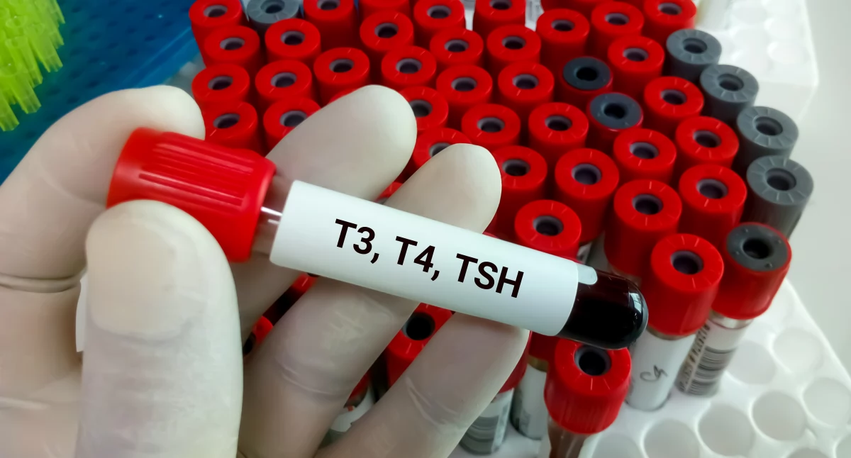 TSH – co to takiego i jak działa TSH? Norma TSH w badaniach